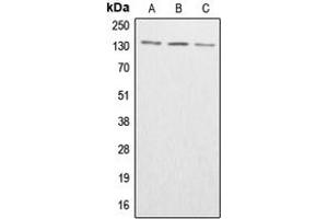 Western blot analysis of ABL1/2 (pY393/439) expression in HeLa colchicine-treated (A), SP2/0 colchicine-treated (B), H9C2 colchicine-treated (C) whole cell lysates.