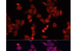 Immunofluorescence analysis of HeLa cells using SMAD2 Polyclonal Antibody at dilution of 1:100. (SMAD2 anticorps)