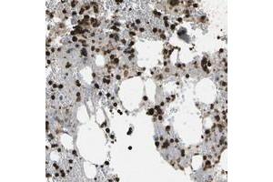 Immunohistochemical staining of human bone marrow with CACHD1 polyclonal antibody  shows strong cytoplasmic positivity in subsets of bone marrow poietic cells at 1:1000-1:2500 dilution. (CACHD1 anticorps)