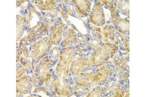 Immunohistochemistry of paraffin-embedded Rat kidney using PPP2R2A Polyclonal Antibody at dilution of 1:100 (40x lens).
