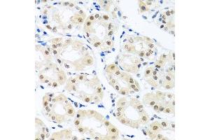 Immunohistochemistry of paraffin-embedded human stomach using THOC1 antibody. (THOC1 anticorps  (AA 428-657))
