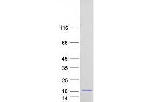 Validation with Western Blot