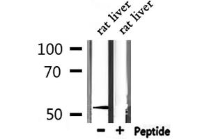 Western blot analysis of extracts from mouse liver, using MeCP2 antibody. (MECP2 anticorps  (N-Term))