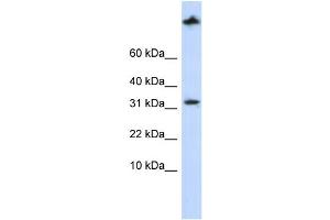 WB Suggested Anti-SCP2 Antibody Titration: 0. (SCP2 anticorps  (Middle Region))