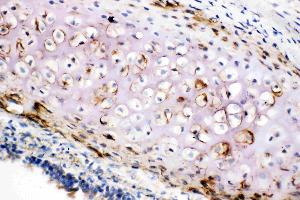 Anti-Collagen II antibody, IHC(F): Rat Trachea Tissue (COL2A1 anticorps  (C-Term))