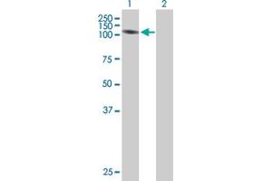 Western Blot analysis of ADD2 expression in transfected 293T cell line by ADD2 MaxPab polyclonal antibody.