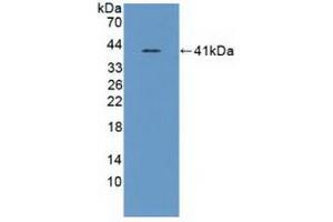 Detection of Recombinant ASNS, Human using Polyclonal Antibody to Asparagine Synthetase (ASNS) (Asparagine Synthetase anticorps  (AA 213-536))