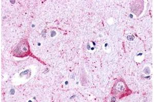 Immunohistochemical staining of human brain, neurons and glia with LPHN2 polyclonal antibody . (LPHN2 anticorps  (N-Term))