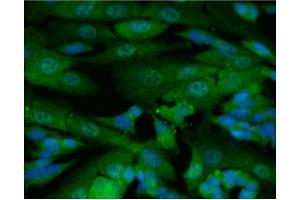 Immunofluorescence (IF) image for anti-Nuclear Receptor Subfamily 3, Group C, Member 1 (Glucocorticoid Receptor) (NR3C1) (AA 176-289) antibody (ABIN968431)