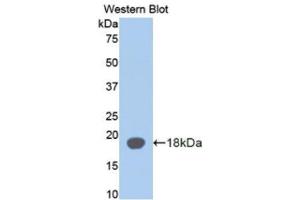 Western Blotting (WB) image for anti-alpha-2-Glycoprotein 1, Zinc-Binding (AZGP1) antibody (Biotin) (ABIN1171671) (AZGP1 anticorps  (Biotin))