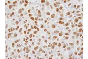 Immunohistochemistry (IHC) image for anti-Histone Deacetylase 1 (HDAC1) (C-Term) antibody (ABIN7448972)