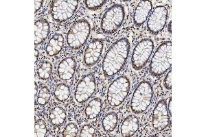 IHC analysis of U1A/SNRPA using anti-U1A/SNRPA antibody (ABIN7600891). (SNRPA1 anticorps  (AA 25-218))