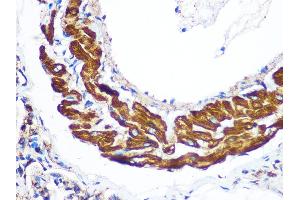 Immunohistochemistry of paraffin-embedded Rat lung using YTHDF2 antibody (ABIN7271427) at dilution of 1:100 (40x lens).