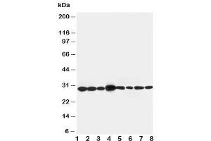 Western blot testing of LASP1 antibody and Lane 1:  rat liver