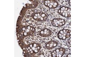 Immunohistochemical staining of human rectum with DSCR3 polyclonal antibody  shows strong cytoplasmic positivity in granular pattern in glandular cells.
