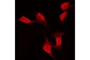 ABIN6275403 staining Hela by IF/ICC. (FAM35A anticorps  (Internal Region))
