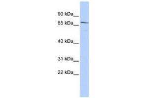 Image no. 1 for anti-Maternal Embryonic Leucine Zipper Kinase (MELK) (AA 432-481) antibody (ABIN6743416)