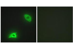 Immunofluorescence analysis of HeLa cells, using DUSP6 antibody. (DUSP6 anticorps  (Internal Region))