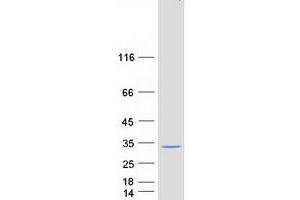 Syntaxin Binding Protein 6 (Amisyn) (STXBP6) protein (Myc-DYKDDDDK Tag)