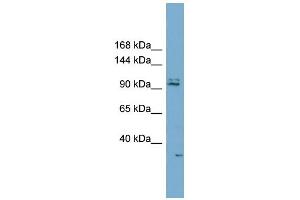 WB Suggested Anti-RC3H2 Antibody Titration:  0. (RC3H2 anticorps  (Middle Region))