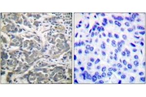 Immunohistochemistry (IHC) image for anti-SNF1A/AMP-Activated Protein Kinase (SNF1A) (AA 140-189) antibody (ABIN2888561) (AMPK alpha anticorps  (AA 140-189))