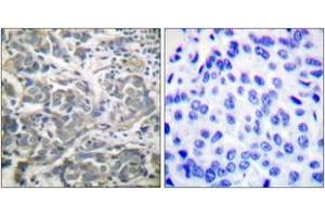 Immunohistochemistry (IHC) image for anti-SNF1A/AMP-Activated Protein Kinase (SNF1A) (AA 140-189) antibody (ABIN2888561) (AMPK alpha anticorps  (AA 140-189))