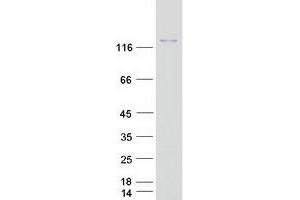 Validation with Western Blot