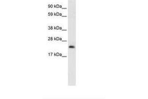 Image no. 1 for anti-High Mobility Group Box 3 (HMGB3) (N-Term) antibody (ABIN202056) (HMGB3 anticorps  (N-Term))