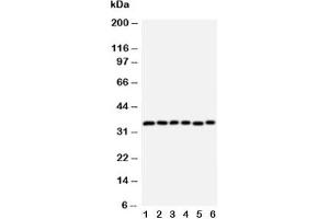 Western blot testing of Aquaporin 4 antibody and Lane 1:  rat heart;  2: rat brain;  3: rat kidney;  4: (h) HT1080;  5: (h) MCF-7;  6: (h) COLO320 cell lysate