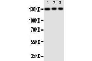 Anti-TLR10 antibody, Western blotting Lane 1: HELA Cell Lysate Lane 2: JURKAT Cell Lysate Lane 3: CEMJ Cell Lysate