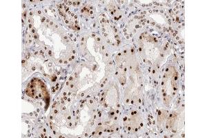 ABIN6267582 at 1/200 staining human kidney tissue sections by IHC-P. (NFKB2 anticorps  (pSer866))