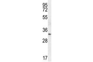 TTF1 antibody western blot analysis in HeLa lysate.