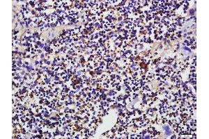 Paraformaldehyde-fixed, paraffin embedded mouse spleen tissue, Antigen retrieval by boiling in sodium citrate buffer(pH6) for 15min, Block endogenous peroxidase by 3% hydrogen peroxide for 30 minutes, Blocking buffer (normal goat serum) at 37°C for 20min, Antibody incubation with CD19 Polyclonal Antibody, Unconjugated  at 1:500 overnight at 4°C, followed by a conjugated secondary and DAB staining