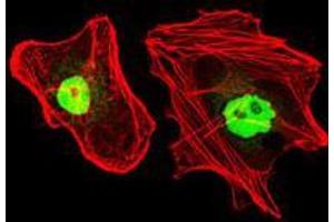 Immunofluorescence analysis of HeLa cells using RPA1 mouse mAb (green).