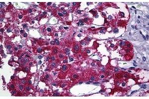 Human Adrenal: Formalin-Fixed, Paraffin-Embedded (FFPE)