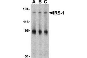 Western Blotting (WB) image for anti-Insulin Receptor Substrate 1 (IRS1) (Middle Region) antibody (ABIN1030966) (IRS1 anticorps  (Middle Region))