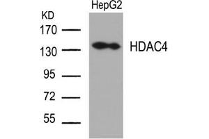 Image no. 2 for anti-Histone Deacetylase 4 (HDAC4) (Ser632) antibody (ABIN197339) (HDAC4 anticorps  (Ser632))
