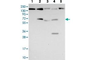 Western blot analysis of Lane 1: RT-4, Lane 2: U-251 MG, Lane 3: Human Plasma, Lane 4: Liver, Lane 5: Tonsil with FAM169A polyclonal antibody  at 1:250-1:500 dilution. (FAM169A anticorps)