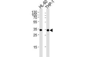 Western Blotting (WB) image for anti-Malate Dehydrogenase 1, NAD (Soluble) (MDH1) antibody (ABIN3001705) (MDH1 anticorps)