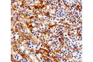 Immunohistochemical analysis of paraffin-embedded human tonsil using FYN antibody at 1:25 dilution.
