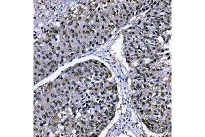 IHC analysis of CSNK2B using anti-CSNK2B antibody (ABIN7599092). (CSNK2B anticorps  (AA 1-215))