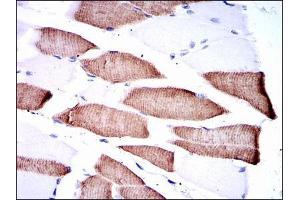 Immunohistochemical analysis of paraffin-embedded muscle tissues using MAP2K7 mouse mAb with DAB staining.