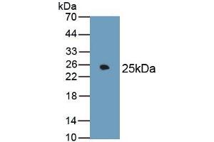 Detection of Recombinant FN, Rat using Monoclonal Antibody to Fibronectin (FN)