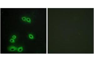 Immunofluorescence analysis of A549 cells, using MUC1 Antibody. (MUC1 anticorps  (AA 1191-1240))