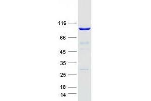 Tetratricopeptide Repeat Domain 27 (TTC27) protein (Myc-DYKDDDDK Tag)