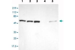 Western blot analysis of Lane 1: RT-4, Lane 2: U-251 MG, Lane 3: A-431, Lane 4: Liver, Lane 5: Tonsil with GPKOW polyclonal antibody  at 1:250-1:500 dilution. (GPKOW anticorps)