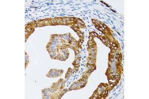 Immunohistochemistry of paraffin-embedded rat fallopian tube using p60 C antibody  at dilution of 1:100 (40x lens).