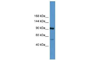 Lp (a) antibody (70R-10023) used at 0. (LPA anticorps  (Middle Region))
