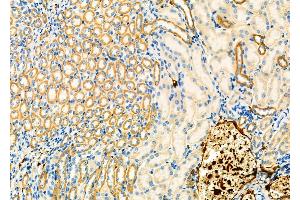 ABIN6265799 and ABIN6266785 at 1/100 staining Mouse kidney tissue by IHC-P. (TUBGCP3 anticorps  (N-Term))