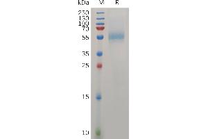 Human ZP3 Protein, His Tag on SDS-PAGE under reducing condition.
